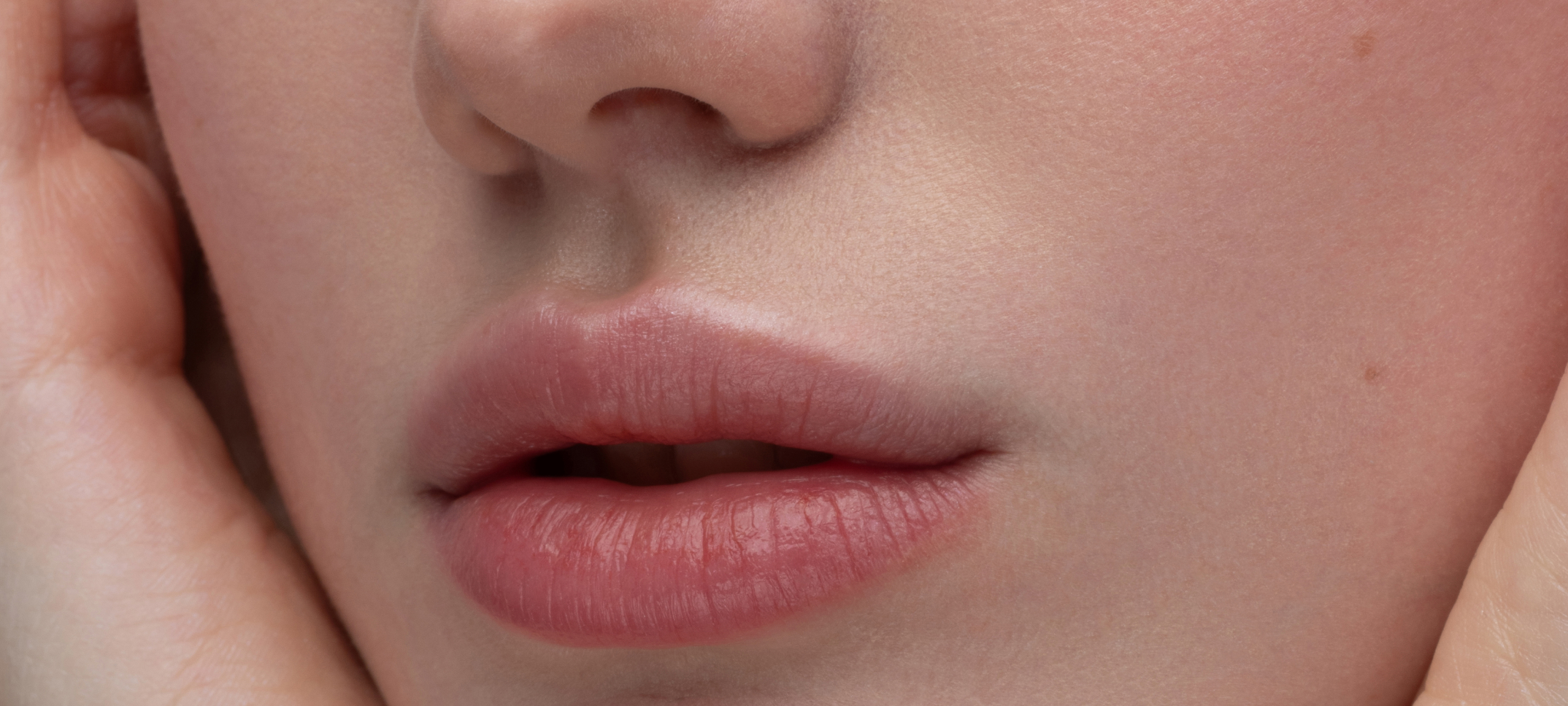 Injections lèvres comment obtenir résultat naturel | Dr Heyfa Ben Youssef | Paris