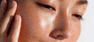 Sculptra combien temps voit résultats | Dr Heyfa Ben Youssef | Paris